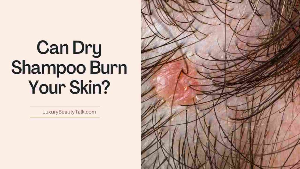 Can Dry Shampoo Burn Your Skin