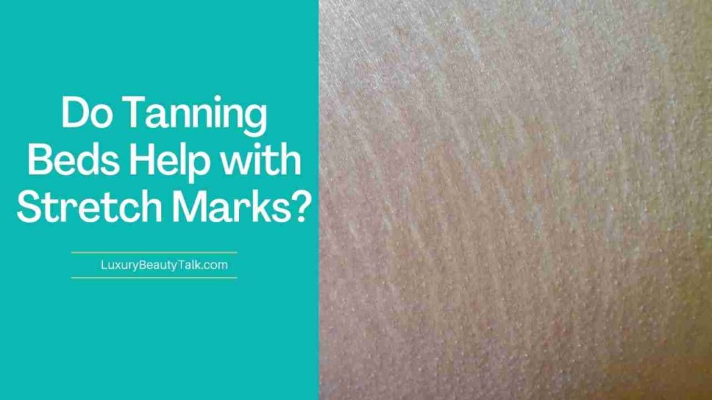 Do Tanning Beds Help with Stretch Marks