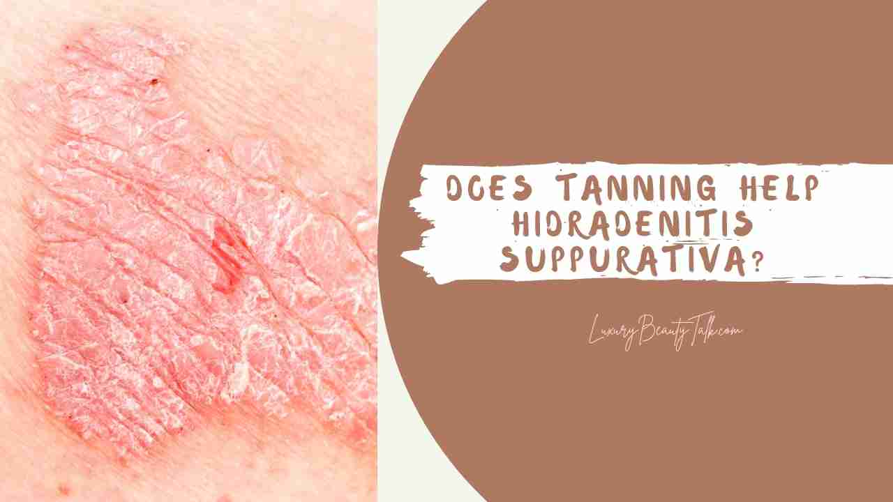 Does Tanning Help Hidradenitis Suppurativa